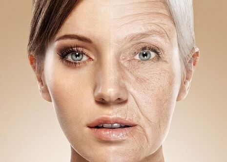 vor und nach der Laser-Gesichtshautverjüngung