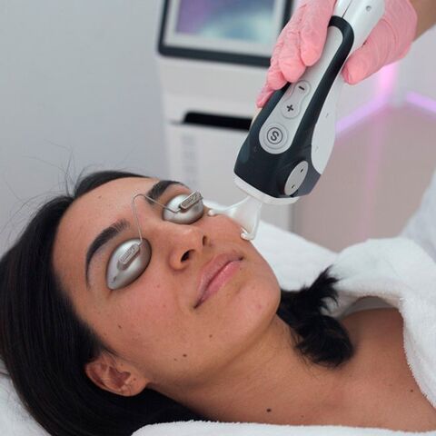 Gesichtsbehandlung mit fraktioniertem Laser